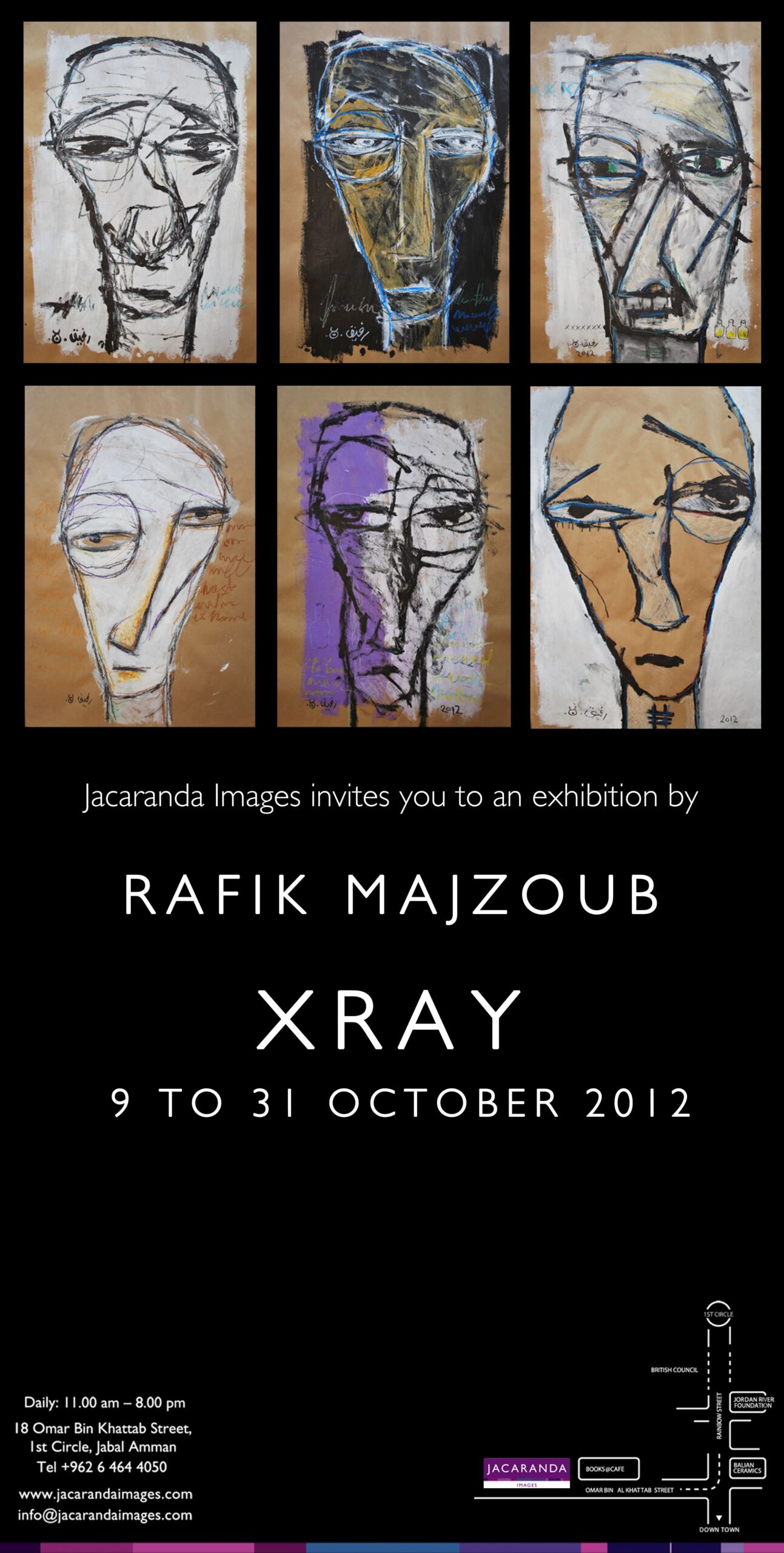 X RAY